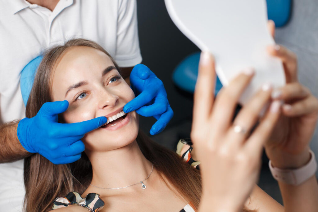 Composite Veneers