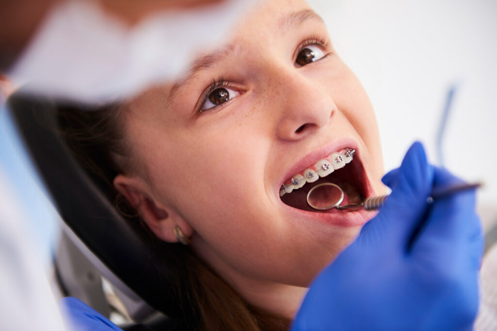 Palatal Expander