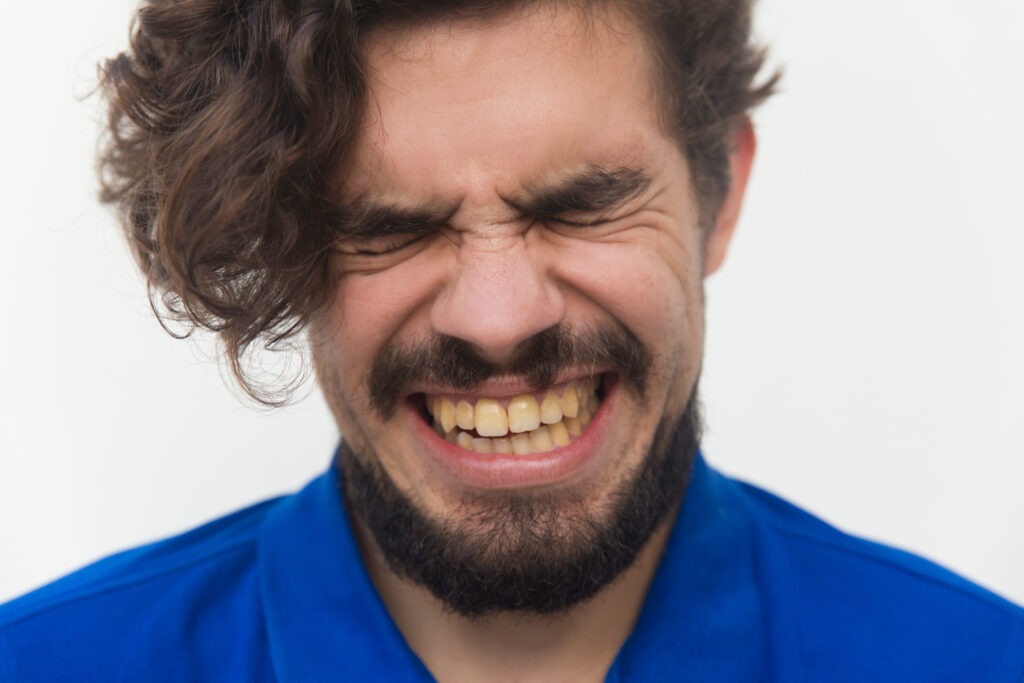 Chipped Tooth