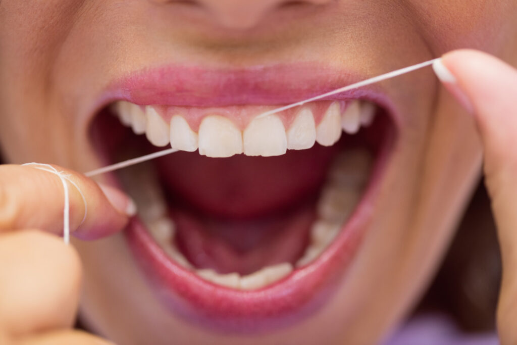 Gum Grafting