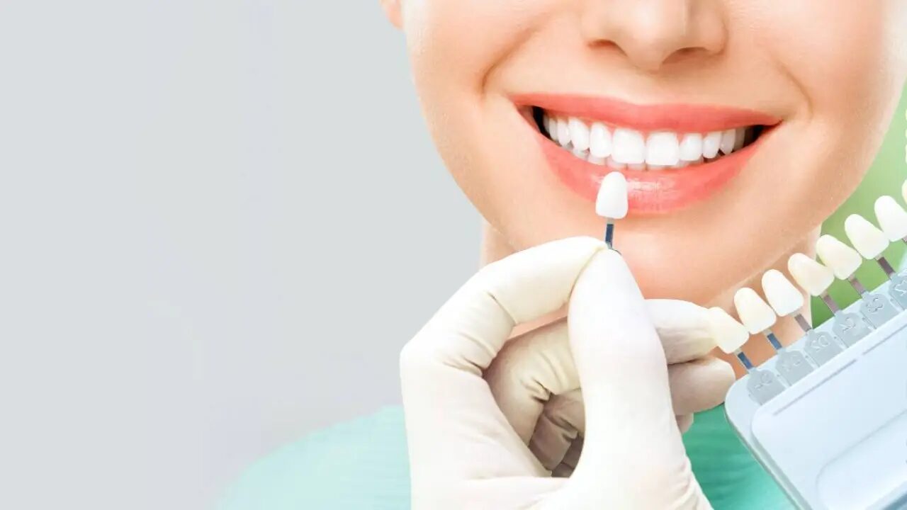 teeth whitening treatment